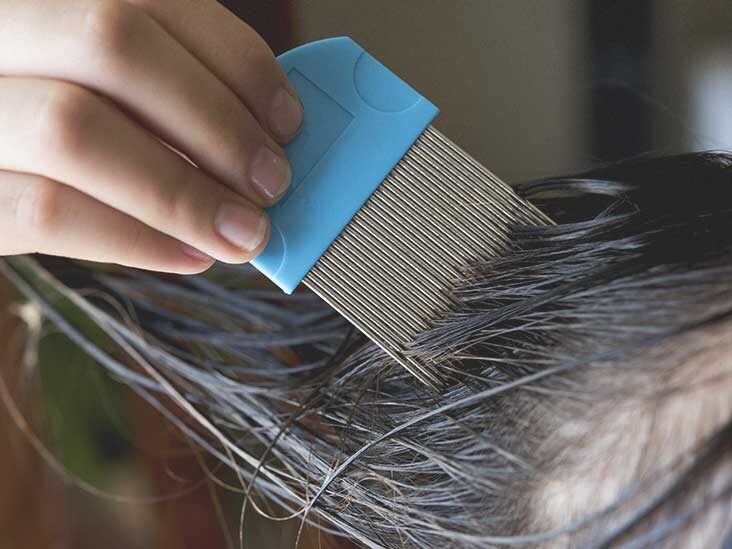 Things to know about lice